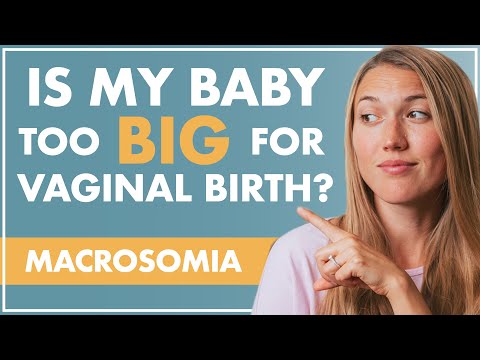 MACROSOMIA | Is My BABY TOO BIG For a Vaginal Birth?