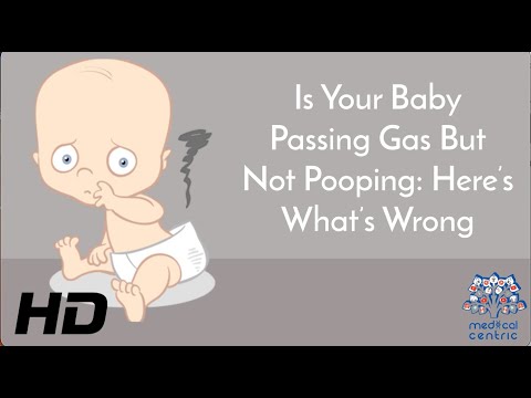 Is Your Baby Passing Gas But Not Pooping:Here's What's Wrong