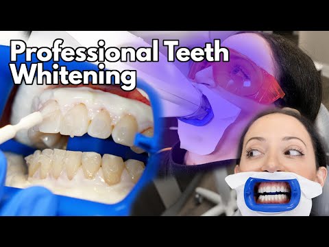 Teeth Whitening At The Dentist | Fastest Way To Whiten Your Teeth