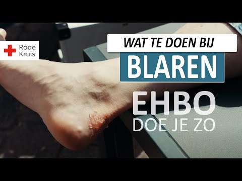 Blaar op de voet! Hoe behandel je een blaar? | EHBO Doe Je Zo - Rode Kruis